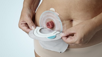 Gestisci la tua sacca per colostomia ileostomia urostomia